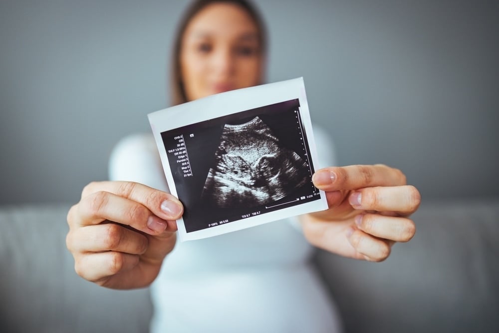 feliz joven embarazada mujer sosteniendo ultrasonido prenatal
