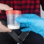Hombre con un copo de esperma en la mano para donación