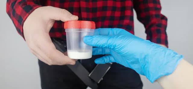 Hombre con un copo de esperma en la mano para donación